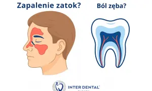Zapalenie zatok czy ból zęba? Ilustracja pokazuje obszary zatok na twarzy i przekrój zęba.