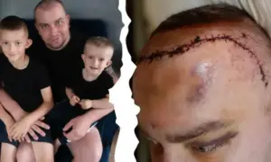 Ojciec z synami i blizna po operacji mózgu. Historia o tym, jak się umiera na glejaka, pokazuje walkę o życie.