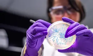 Badacz w fioletowych rękawiczkach analizuje płytkę Petriego z licznymi koloniami bakterii, w tym escherichia coli, pod światłem.