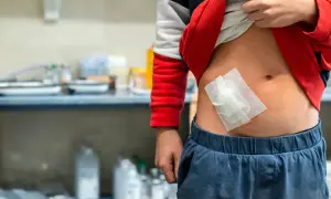 Dziecko z opatrunkiem na brzuchu, po urazie, który mógł spowodować wstrząs hipowolemiczny.