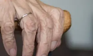 Jak często można jechać do sanatorium z NFZ? Oto kluczowe informacje