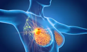 Anatomia piersi z widocznym guzem i węzłami chłonnymi. Ból pod pachą może być objawem.