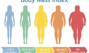 Pięć sylwetek kobiet o różnej budowie ciała, od szczupłej do bardzo otyłej, ilustruje kategorie BMI. Nadmierna masa ciała może prowadzić do zespołu metabolicznego.