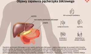 Anatomia człowieka z zaznaczonym pęcherzykiem żółciowym, wątrobą i żołądkiem. Obok objawy zapalenia pęcherzyka żółciowego.