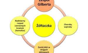 Schemat przedstawia żółtaczkę jako centralny element, powiązaną z zespołem Gilberta, chorobami wątroby, zastojem żółci i nadmiernym rozpadem czerwonych krwinek.