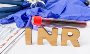 Litery INR na tle rękawiczek, stetoskopu i probówek z krwią. Wynik badania czasu protrombinowego.