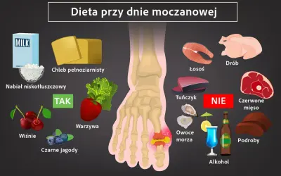 Dieta przy dnie moczanowej: TAK - nabiał niskotłuszczowy, chleb pełnoziarnisty, warzywa, wiśnie, czarne jagody. NIE - drób, łosoś, tuńczyk, czerwone mięso, owoce morza, alkohol, podroby. Jak obniżyć kwas moczowy?