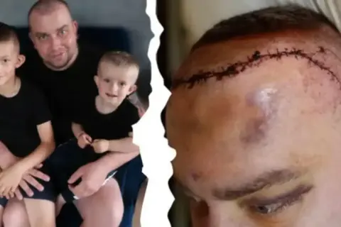 Ojciec z synami i blizna po operacji mózgu. Historia o tym, jak się umiera na glejaka, pokazuje walkę o życie.