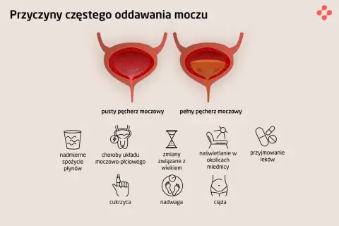 Ilustracja przedstawia przyczyny częstego oddawania moczu: nadmierne picie, choroby układu moczowo-płciowego, wiek, naświetlanie miednicy, leki, cukrzyca, nadwaga, ciąża.