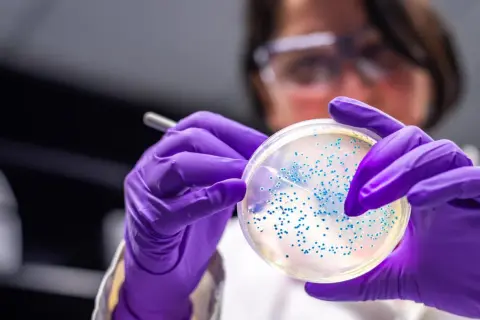 Badacz w fioletowych rękawiczkach analizuje płytkę Petriego z licznymi koloniami bakterii, w tym escherichia coli, pod światłem.
