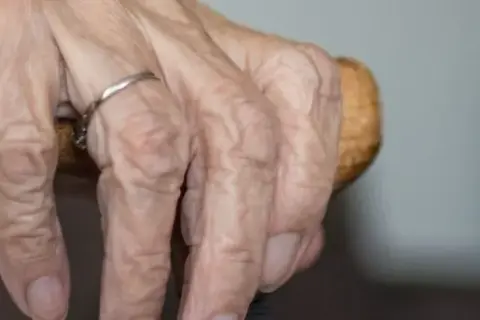Jak często można jechać do sanatorium z NFZ? Oto kluczowe informacje