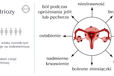 Objawy endometriozy: ból, osłabienie, nadmierne krwawienie, niestrawność, bezpłodność, mdłości, bolesny stosunek, bolesne miesiączki. 1 na 10 kobiet choruje.