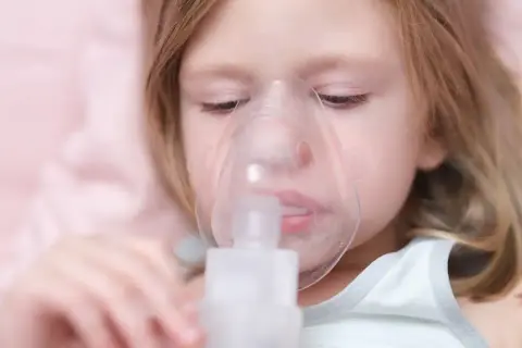 Mała dziewczynka z maską inhalatora na twarzy. Pomaga jej to w leczeniu kaszlu.