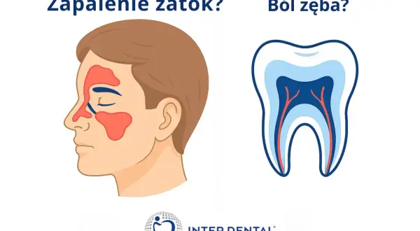 Zapalenie zatok czy ból zęba? Ilustracja pokazuje obszary zatok na twarzy i przekrój zęba.
