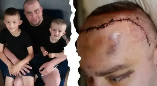 Ojciec z synami i blizna po operacji mózgu. Historia o tym, jak się umiera na glejaka, pokazuje walkę o życie.