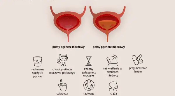 Ilustracja przedstawia przyczyny częstego oddawania moczu: nadmierne picie, choroby układu moczowo-płciowego, wiek, naświetlanie miednicy, leki, cukrzyca, nadwaga, ciąża.