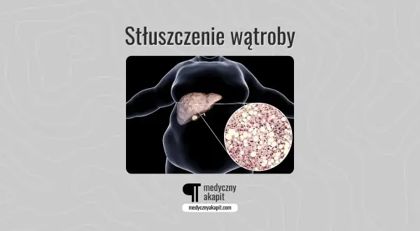 Stłuszczenie wątroby: obraz przedstawia sylwetkę osoby z widoczną wątrobą i powiększony fragment tkanki wątrobowej z komórkami tłuszczowymi.