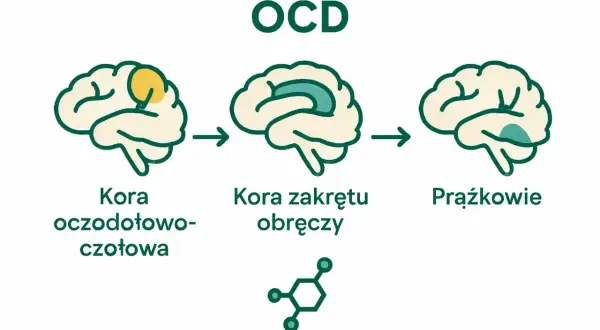 Schemat mózgu ilustrujący zaburzenia obsesyjno-kompulsyjne (OCD). Pokazuje zmiany w korze oczodołowo-czołowej, korze zakrętu obręczy i jądrach podstawy.