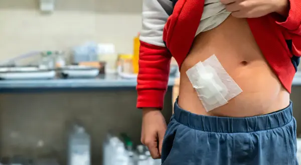 Dziecko z opatrunkiem na brzuchu, po urazie, który mógł spowodować wstrząs hipowolemiczny.