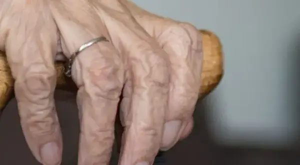 Jak często można jechać do sanatorium z NFZ? Oto kluczowe informacje