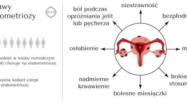 Objawy endometriozy: ból, osłabienie, nadmierne krwawienie, niestrawność, bezpłodność, mdłości, bolesny stosunek, bolesne miesiączki. 1 na 10 kobiet choruje.