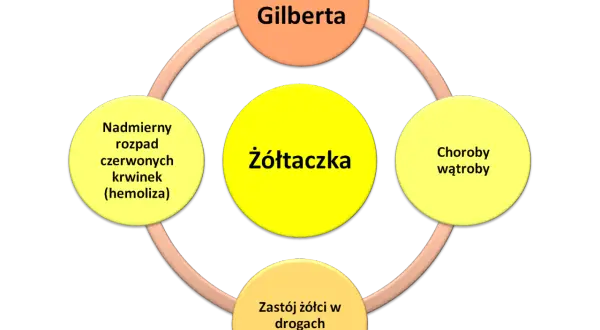 Schemat przedstawia żółtaczkę jako centralny element, powiązaną z zespołem Gilberta, chorobami wątroby, zastojem żółci i nadmiernym rozpadem czerwonych krwinek.