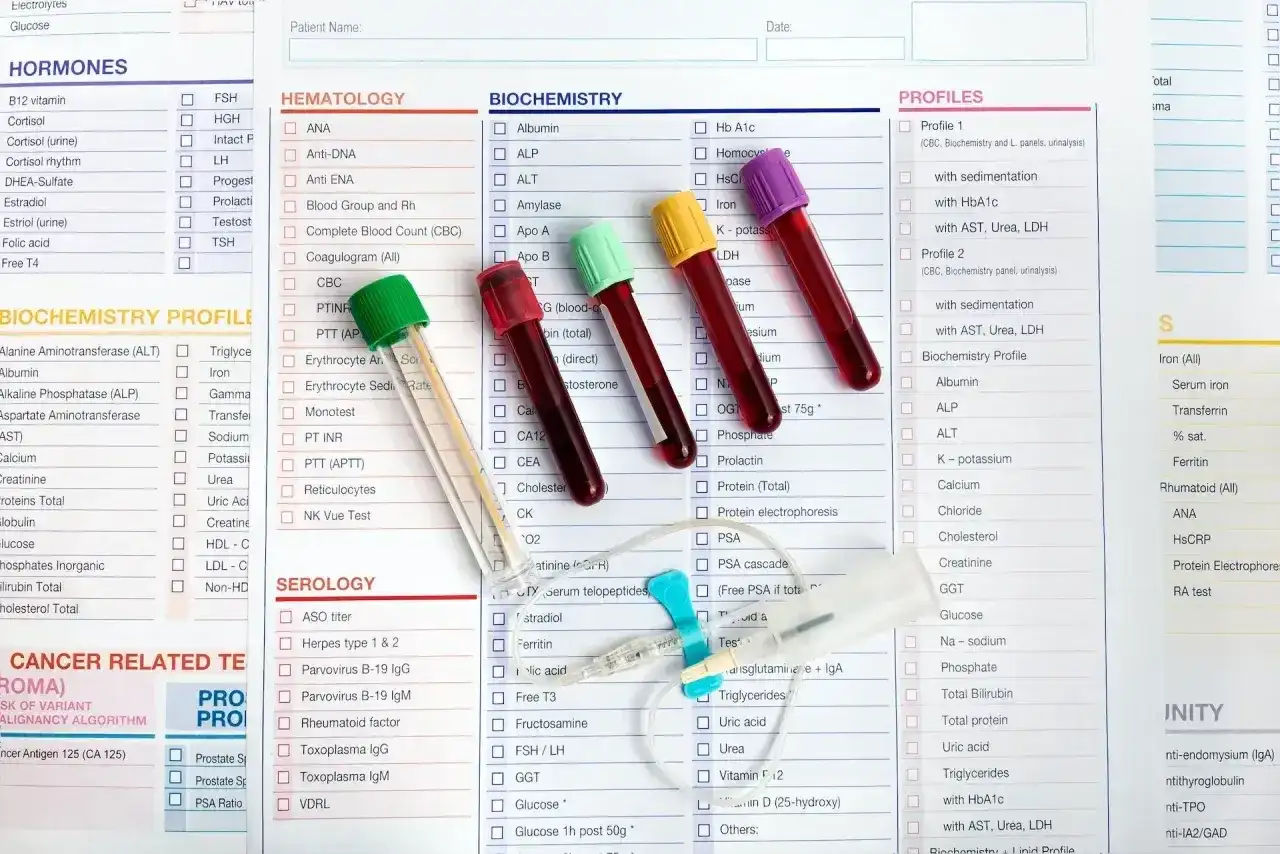 Wyniki badań laboratoryjnych: morfologia z rozmazem, biochemia, hormony, profile. Próbówki z krwią.