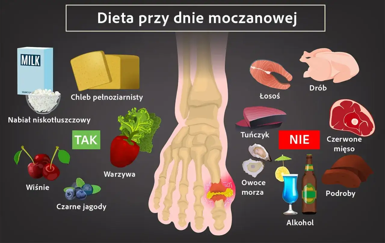 Dieta przy dnie moczanowej: TAK - nabiał niskotłuszczowy, chleb pełnoziarnisty, warzywa, wiśnie, czarne jagody. NIE - drób, łosoś, tuńczyk, czerwone mięso, owoce morza, alkohol, podroby. Jak obniżyć kwas moczowy?