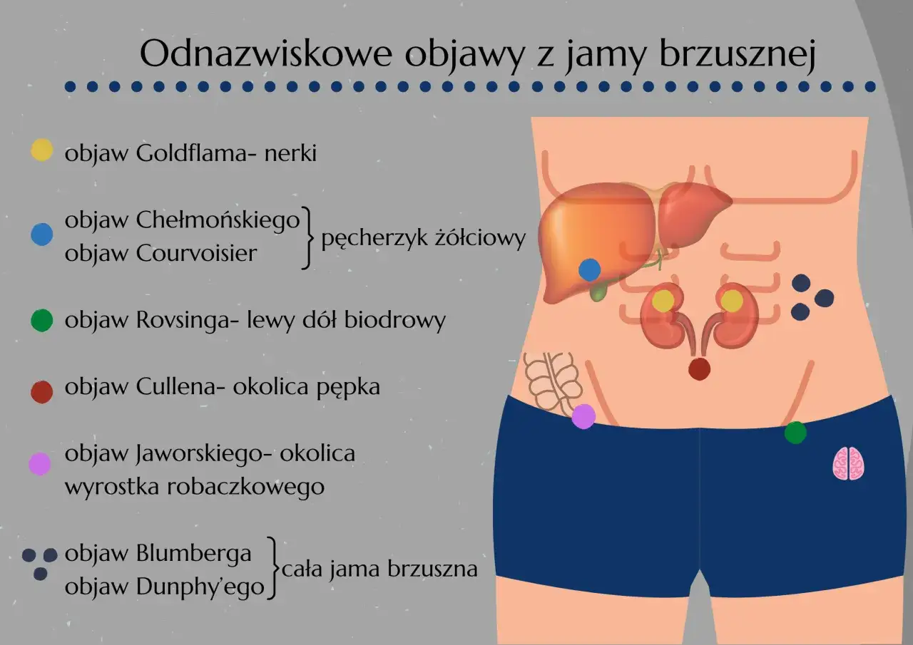 Objaw Blumberga, wskazujący na podrażnienie otrzewnej w całej jamie brzusznej, jest jednym z objawów omawianych na schemacie.