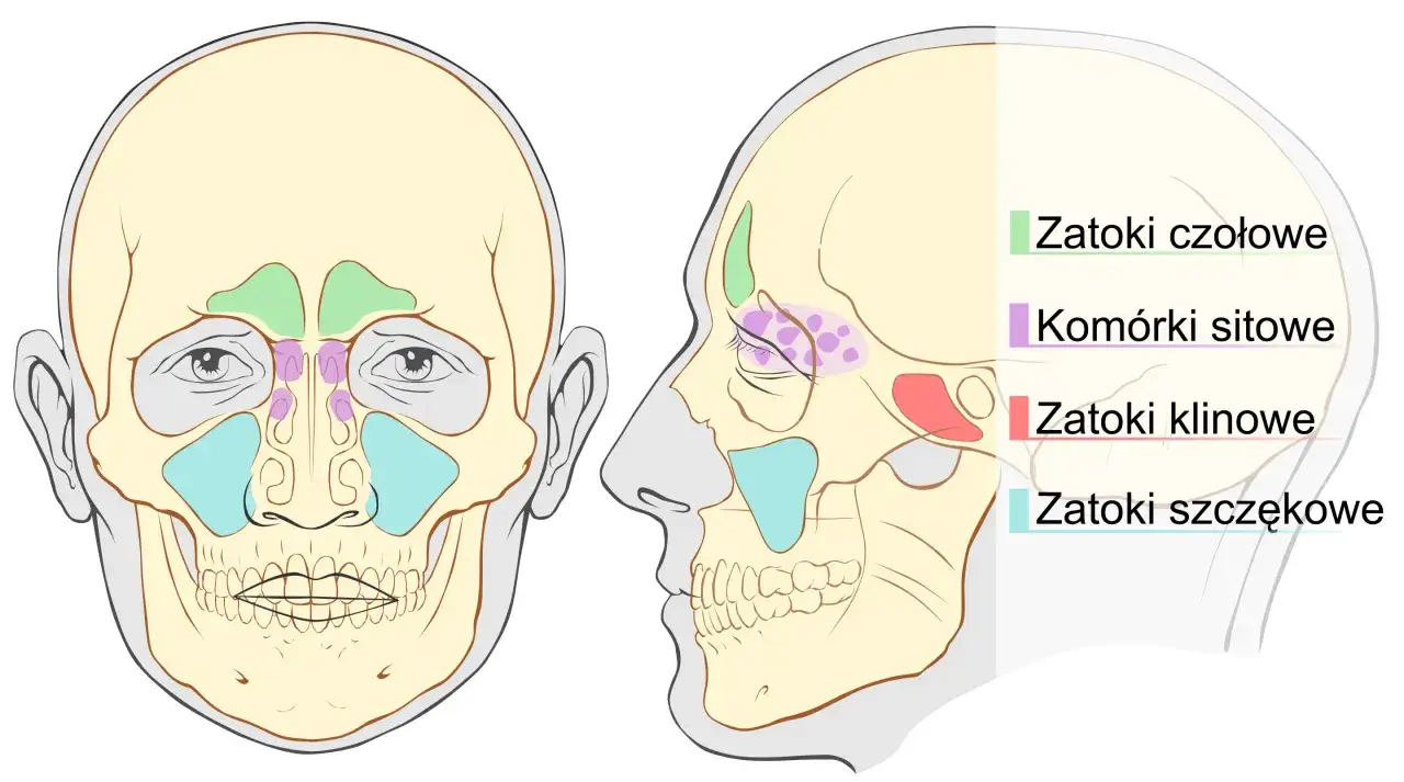 Ilustracja przedstawia budowę czaszki z zaznaczonymi zatokami. Ból zatok może dotyczyć zatok czołowych, sitowych, klinowych i szczękowych.