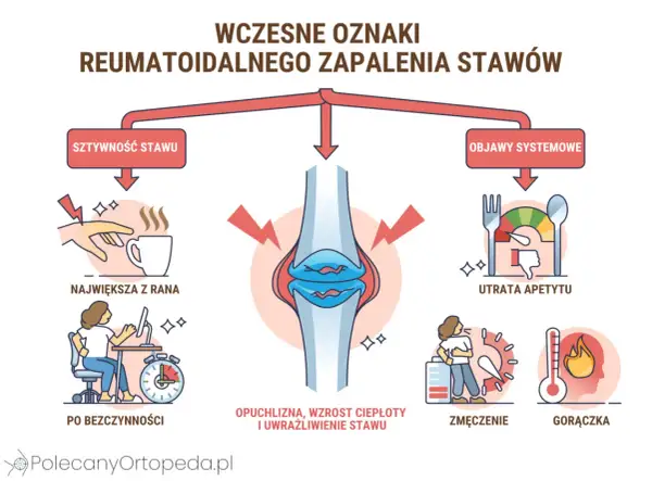 Ilustracja pokazuje wczesne objawy reumatoidalnego zapalenia stawów: sztywność stawów, utratę apetytu, zmęczenie i gorączkę.