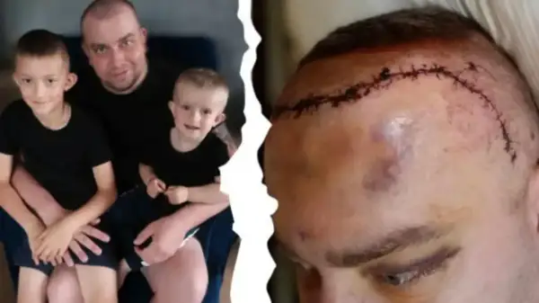 Ojciec z synami i blizna po operacji mózgu. Historia o tym, jak się umiera na glejaka, pokazuje walkę o życie.