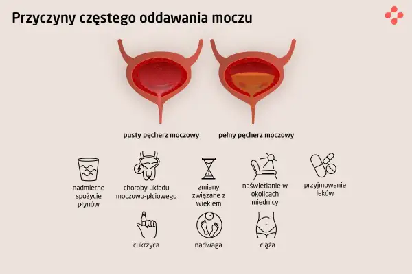Ilustracja przedstawia przyczyny częstego oddawania moczu: nadmierne picie, choroby układu moczowo-płciowego, wiek, naświetlanie miednicy, leki, cukrzyca, nadwaga, ciąża.